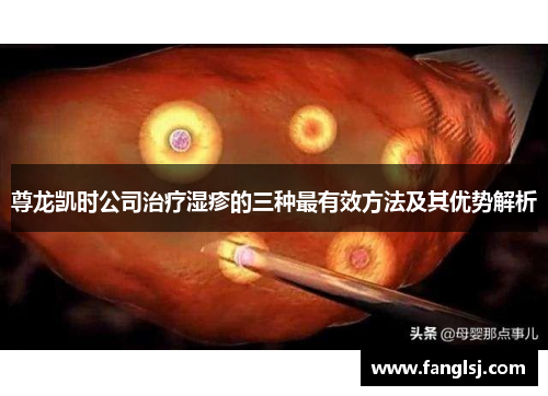 尊龙凯时公司治疗湿疹的三种最有效方法及其优势解析